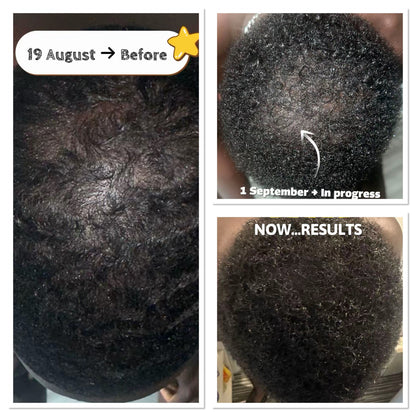 Hair Growth Oil 100ml